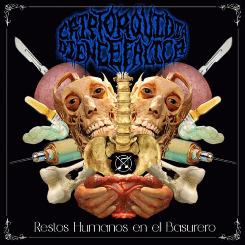 Restos Humanos en el Basurero